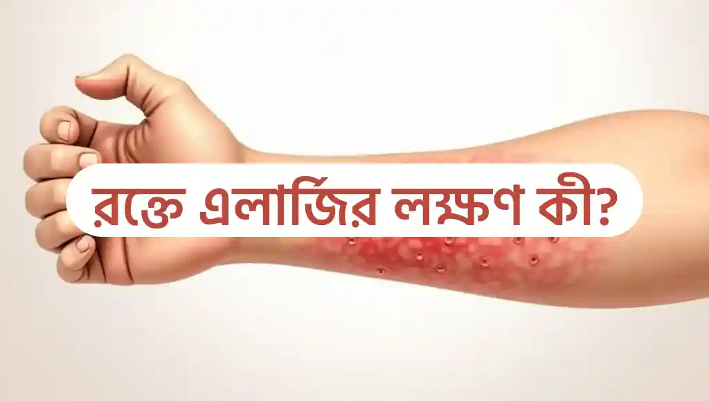 রক্তের এলার্জি দূর করার উপায় কি|রক্তে এলার্জির লক্ষণ